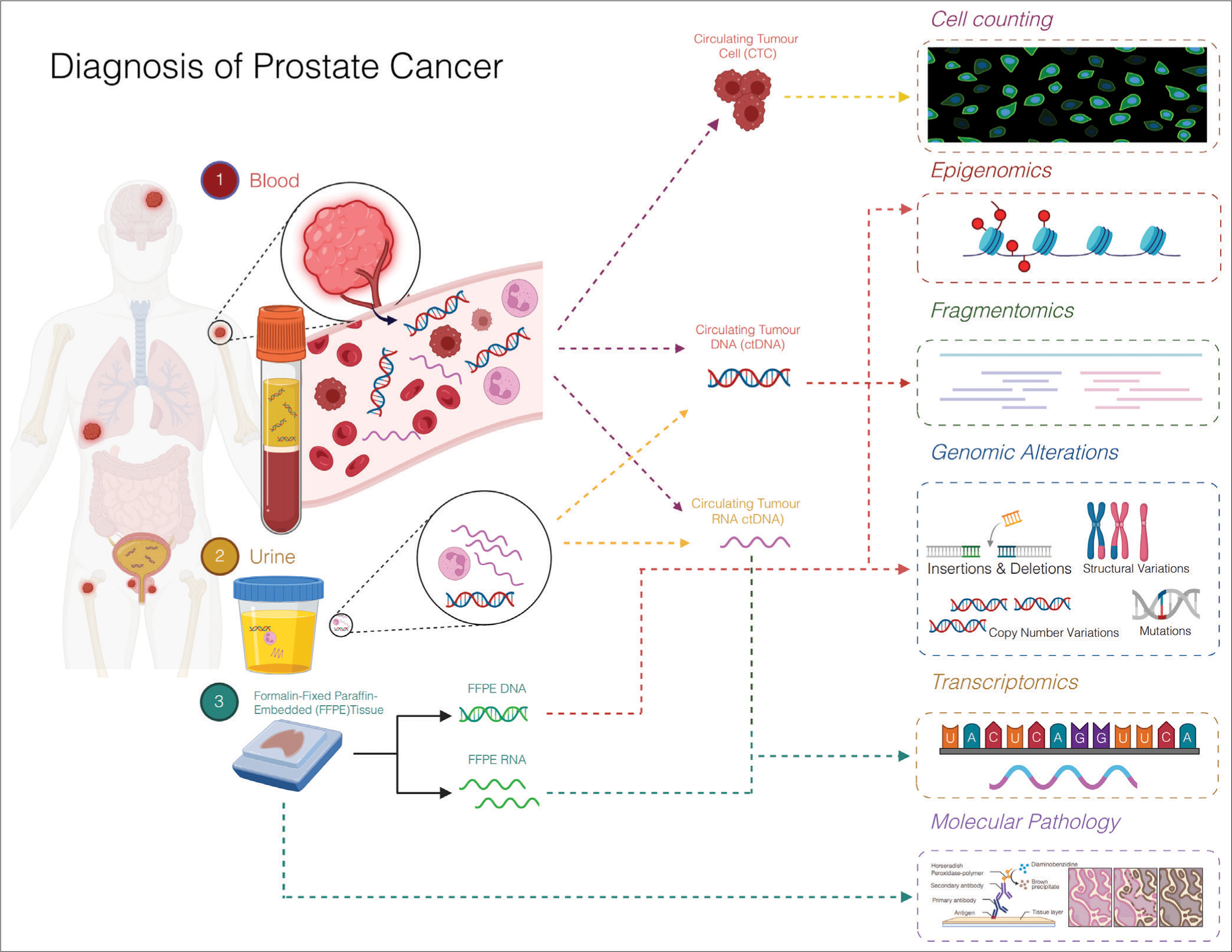 From microscopes to molecules: The evolution of prostate cancer diagnostics