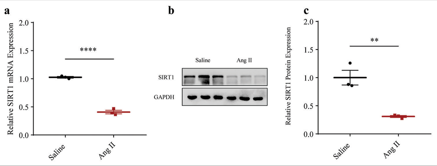 A preliminary study of sirtuin-1 on angiotensin II-induced senescence and inflammation in abdominal aortic aneurysms