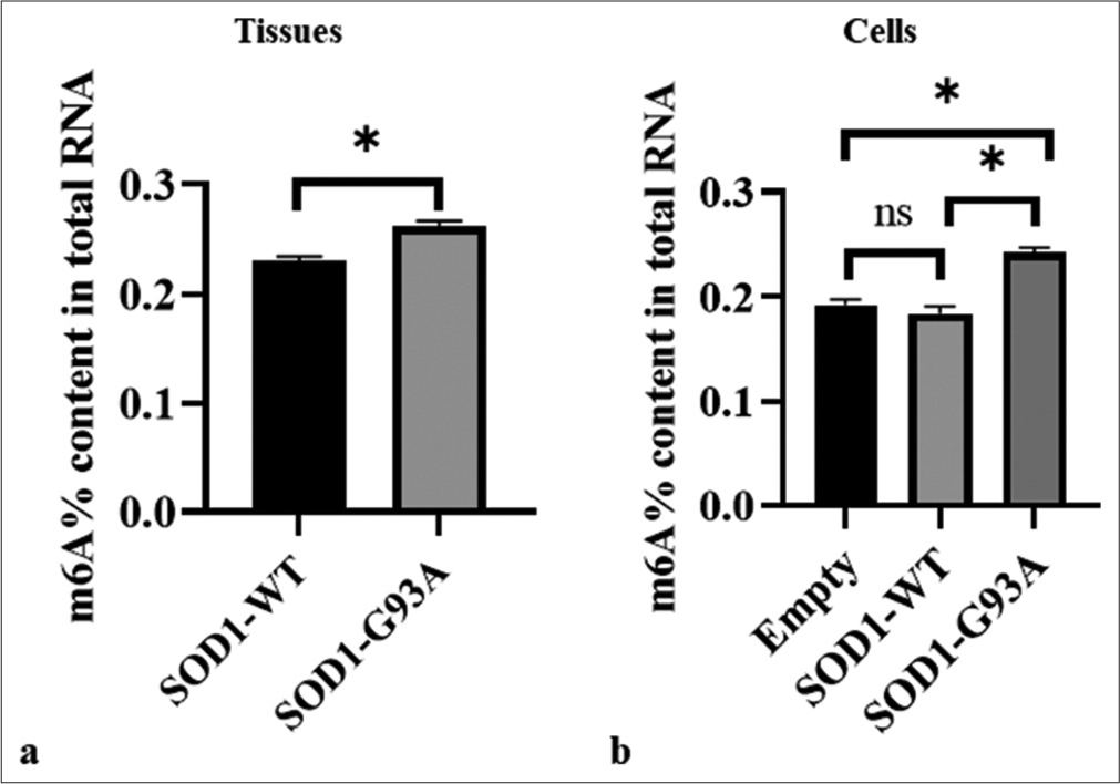 Evidence for the potential role of m6A modification in regulating autophagy in models of amyotrophic lateral sclerosis