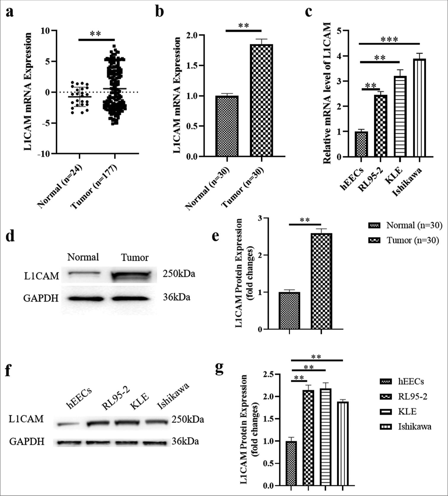 The mechanism of L1 cell adhesion molecule interacting with protein tyrosine kinase 2 to regulate the focal adhesion kinase–growth factor receptor-bound protein 2–son of sevenless–rat sarcoma pathway in the identification and treatment of type I high-risk endometrial cancer