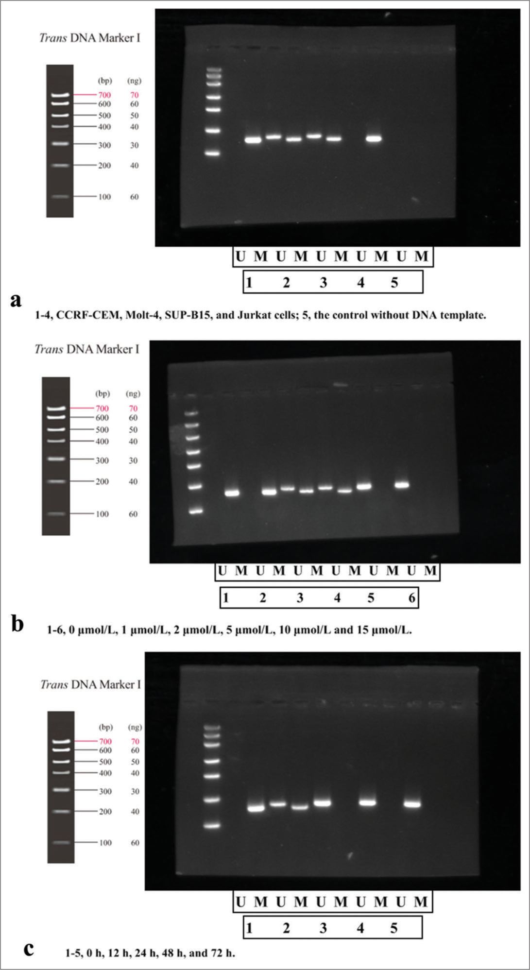 Effect of 5-Aza-2’-deoxycytidine on T-cell acute lymphoblastic leukemia cell biological behaviors and PTEN expression