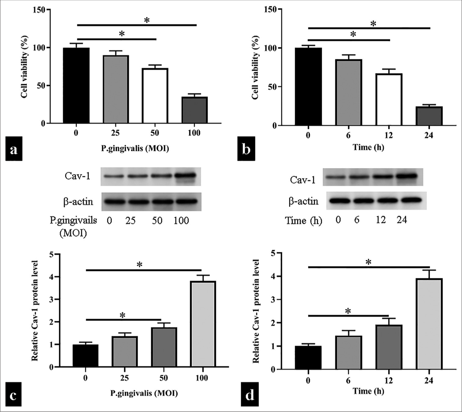 Increased caveolin 1 by human antigen R exacerbates Porphyromonas gingivali-induced atherosclerosis by modulating oxidative stress and inflammatory responses