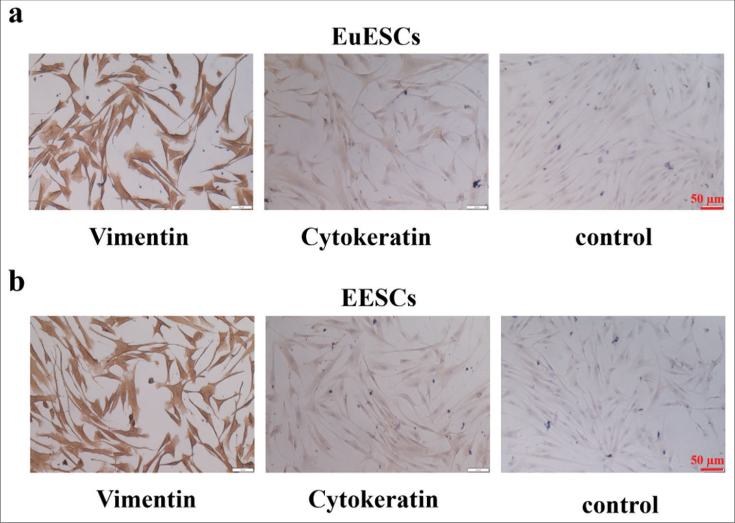 Inhibition of lysine-specific histone demethylase 1A suppresses adenomyosis through reduction in ectopic endometrial stromal cell proliferation, migration, and invasion