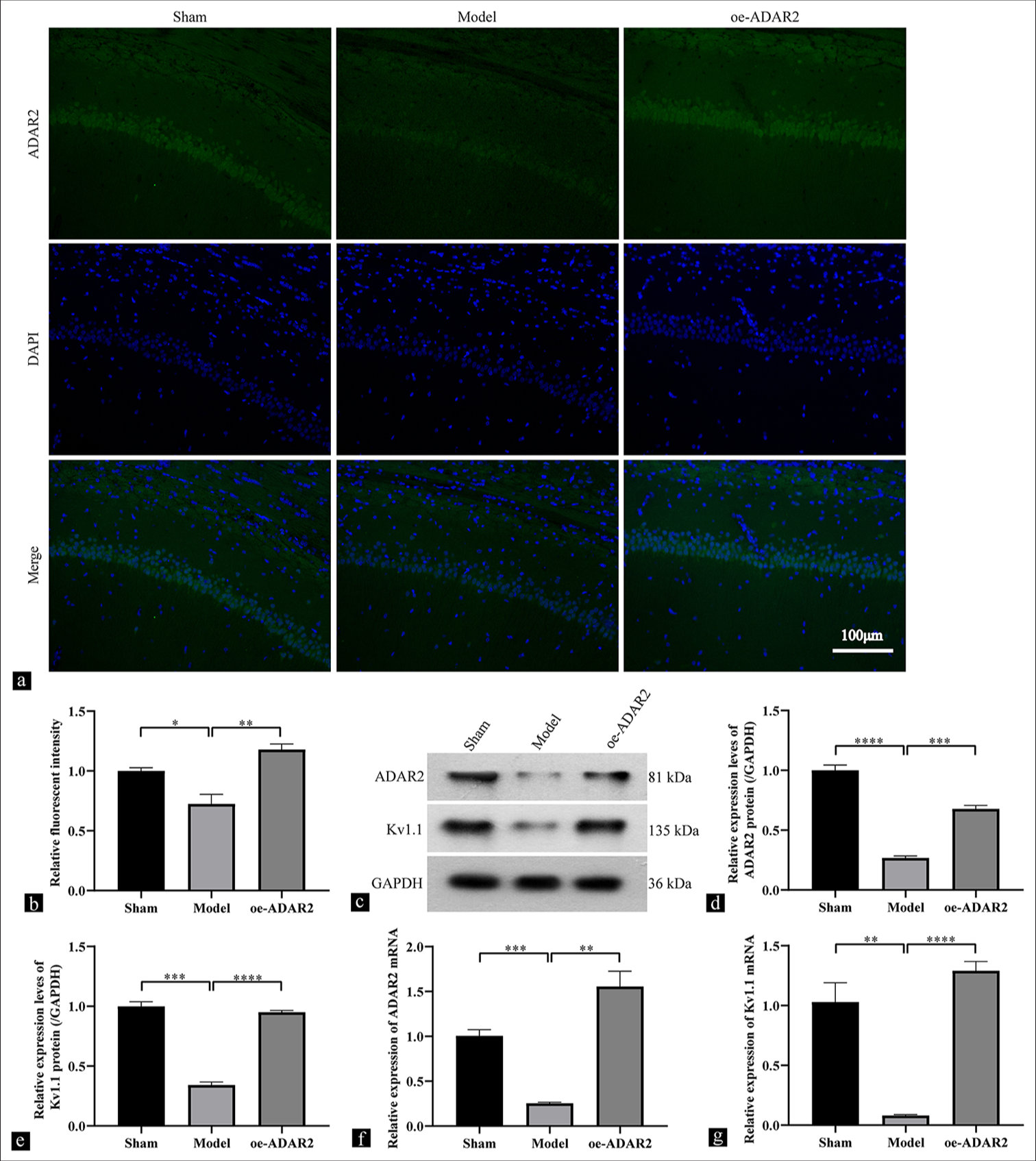 Adenosine deaminase acting on RNA 2 provides neuroprotection by activating Kv1.1 channels in a rat epilepsy model