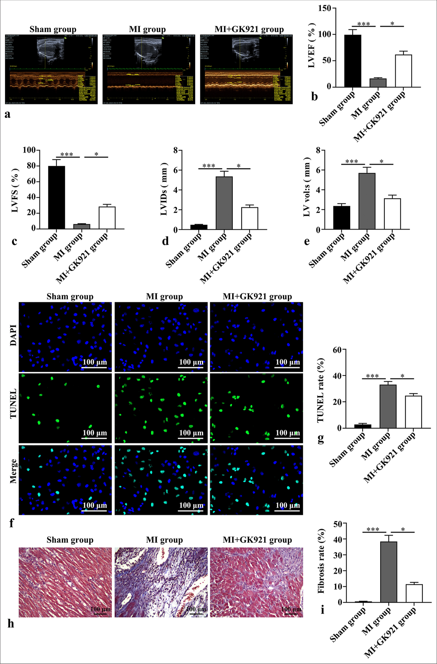 Transglutaminase 2 inhibition ameliorates cardiac fibrosis in myocardial infarction by inducing M2 macrophage polarization in vitro and in vivo