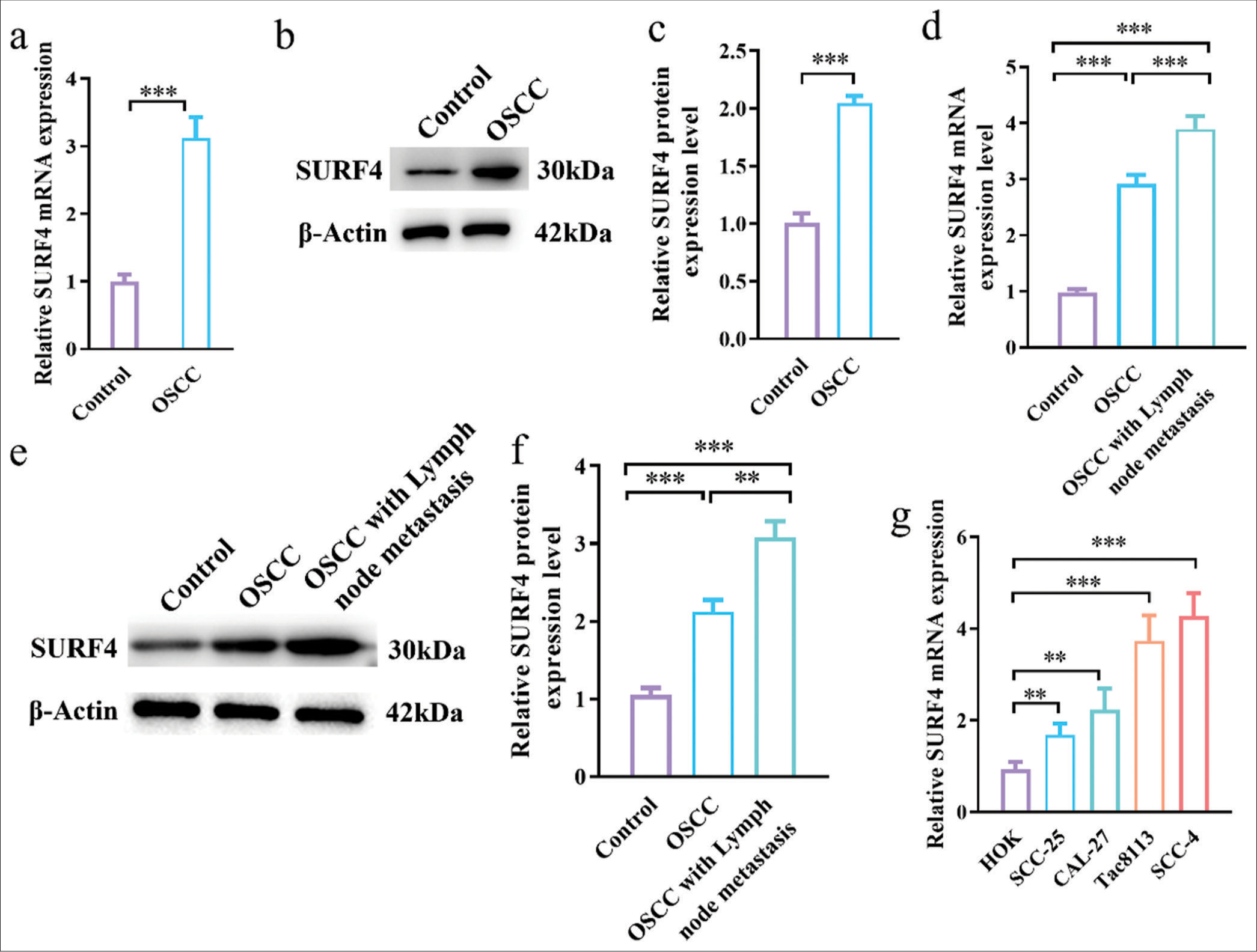 Surfeit 4 regulates aerobic glycolysis to enhanced proliferation, tumor stemness, invasion, and metastasis in oral squamous cell carcinoma