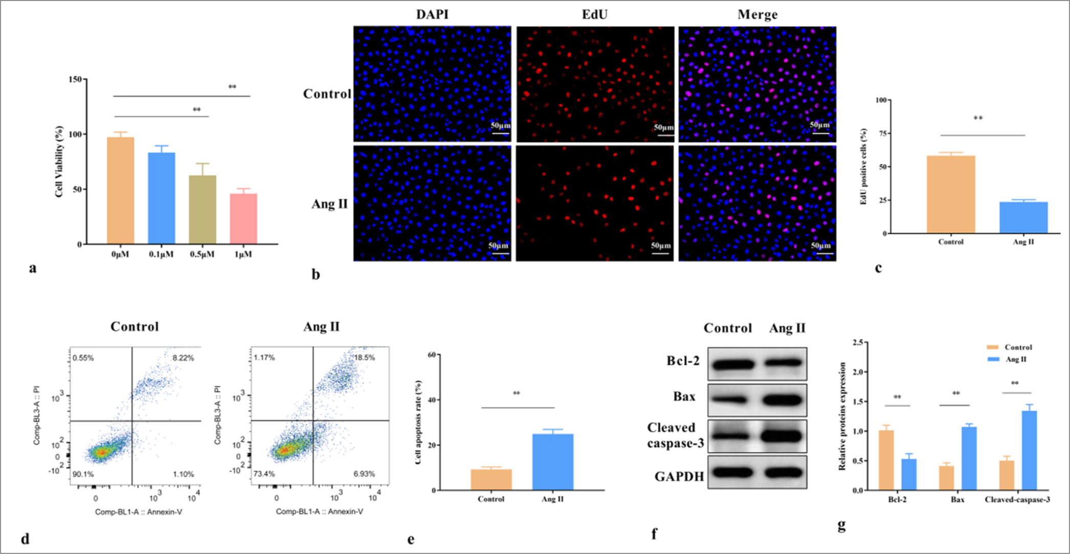 Prenyl diphosphate synthase subunit 2 is downregulated in abdominal aortic aneurysm and retards the progression of abdominal aortic aneurysm