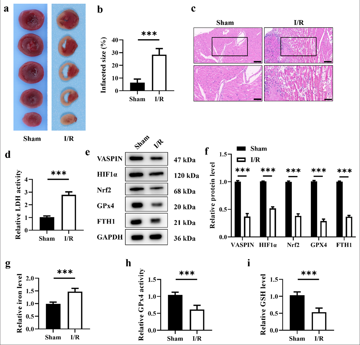 Vaspin inhibits ferroptosis: A new hope for treating myocardial ischemia–reperfusion injury