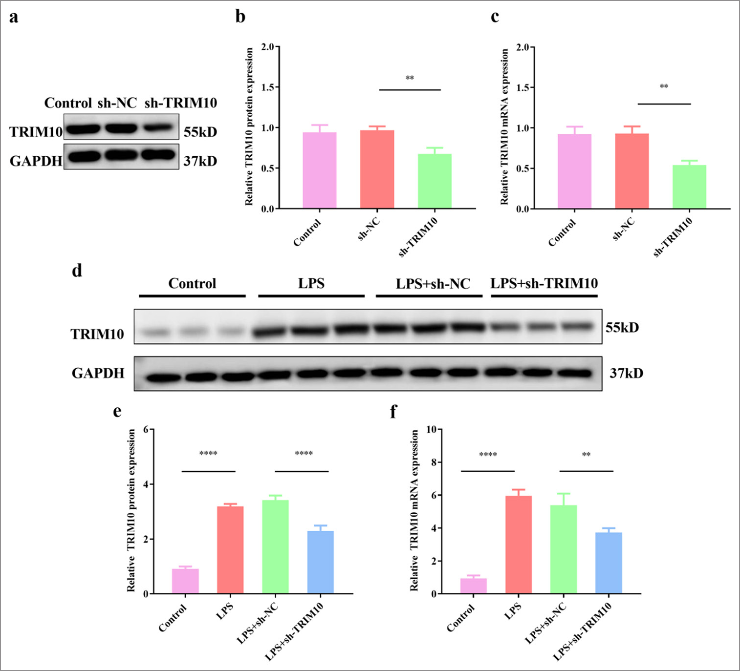 A mechanism study of tripartite motif 10 modulating septic cardiomyopathy