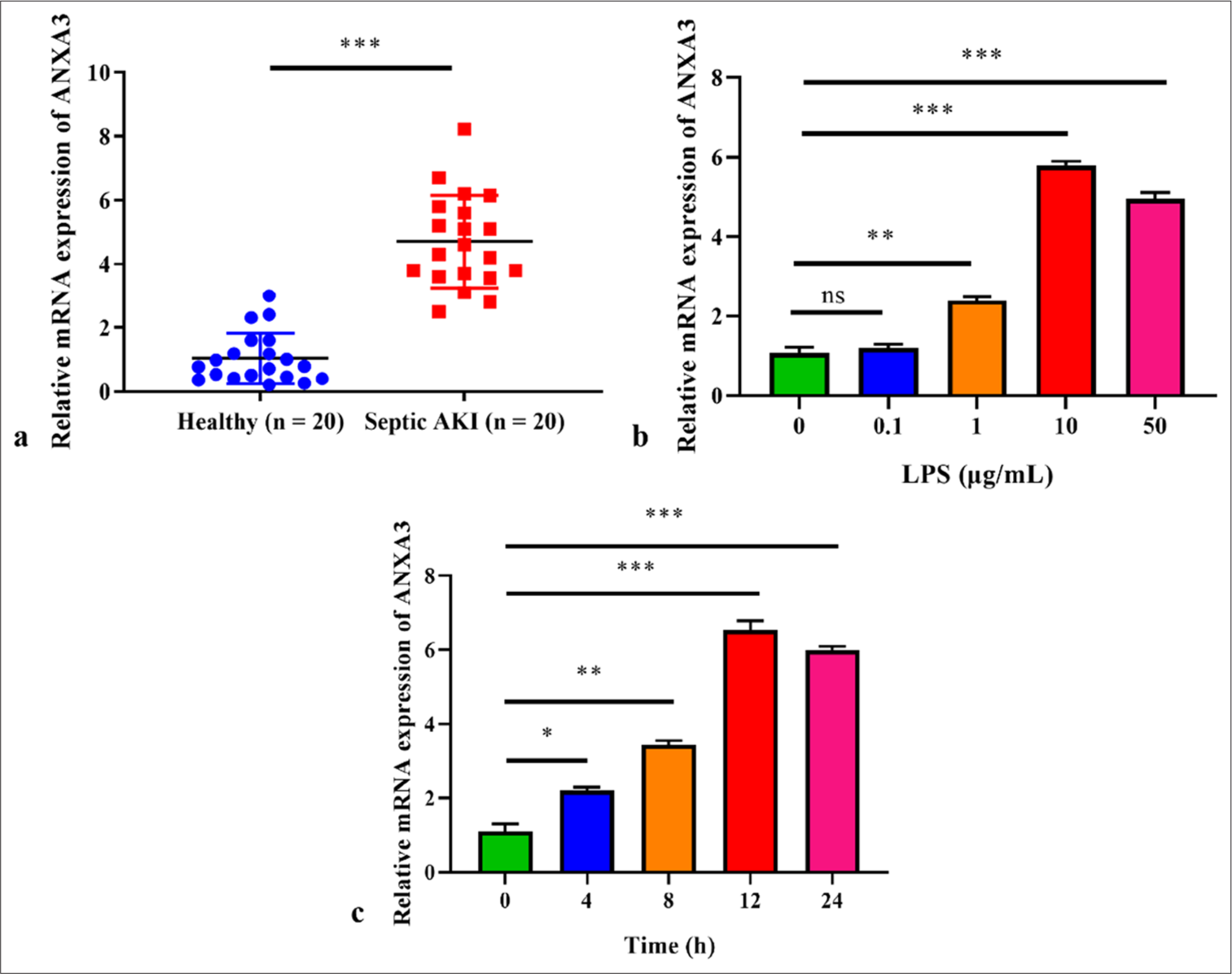 Knocking-down annexin A3 suppresses inflammation, oxidative stress, apoptosis, and endoplasmic reticulum stress to attenuate sepsis-induced acute kidney injury in HK2 cells