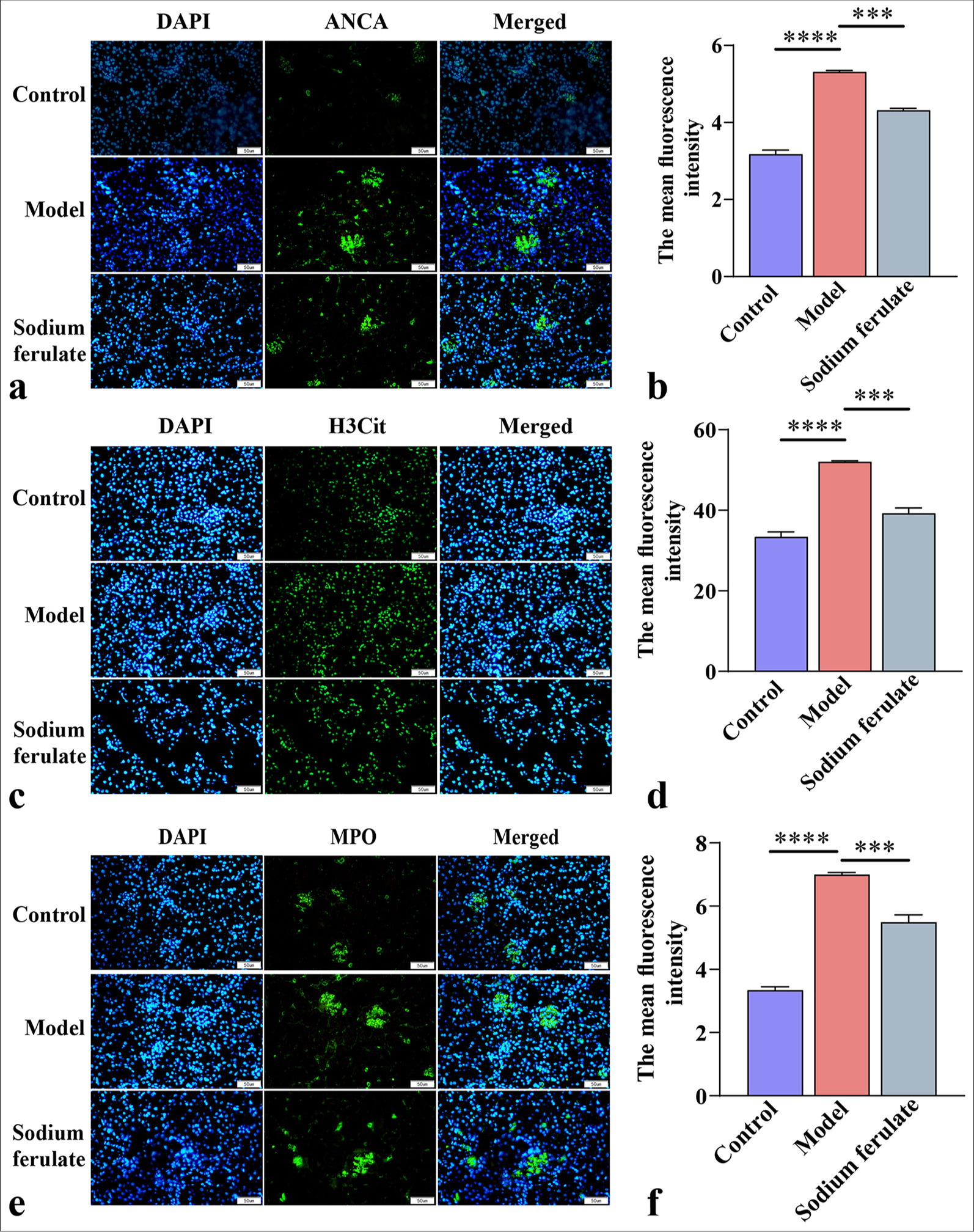 Influence of sodium ferulate on neutrophil extracellular traps-platelet activation-mediated endothelial dysfunction in immune small vasculitis