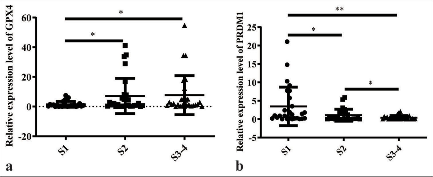 PR/SET domain 1 targeting glutathione peroxidase 4 regulates chronic hepatitis B liver fibrosis through ferroptosis