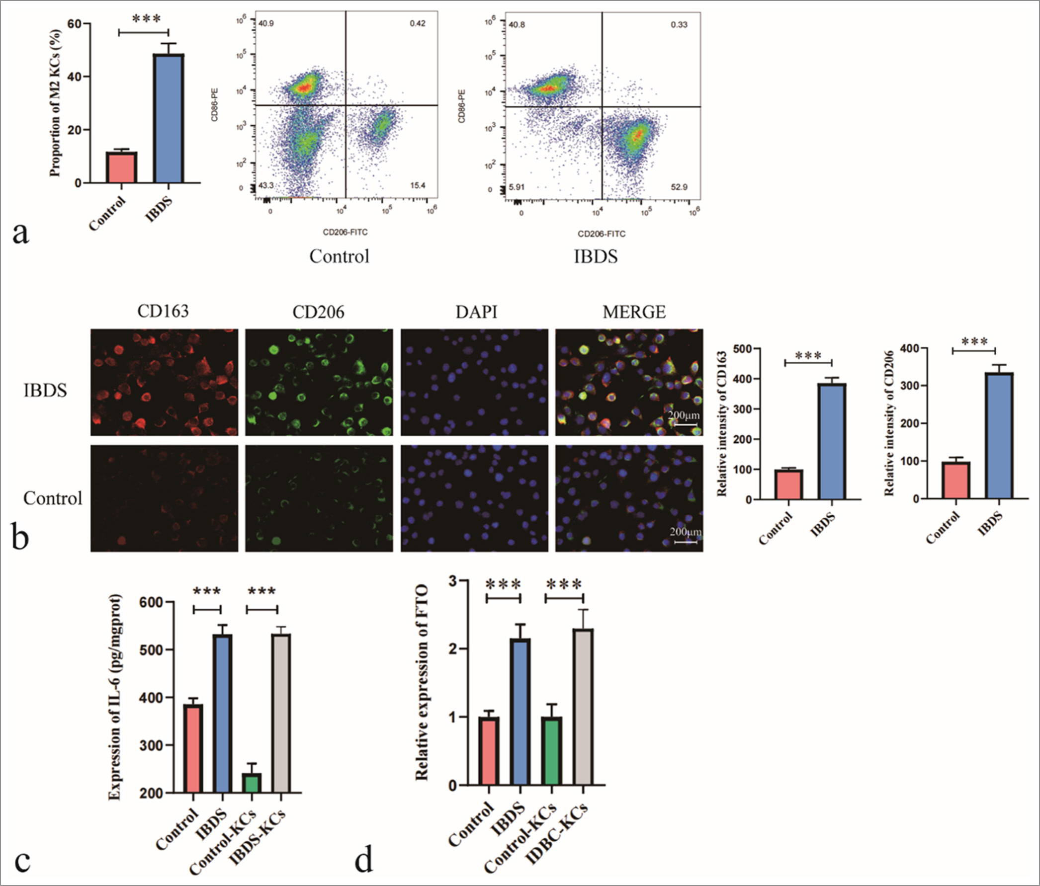 FTO-mediated regulation of Kupffer cell polarization and interleukin-6 secretion promotes biliary epithelial cell proliferation in intrahepatic bile duct stones