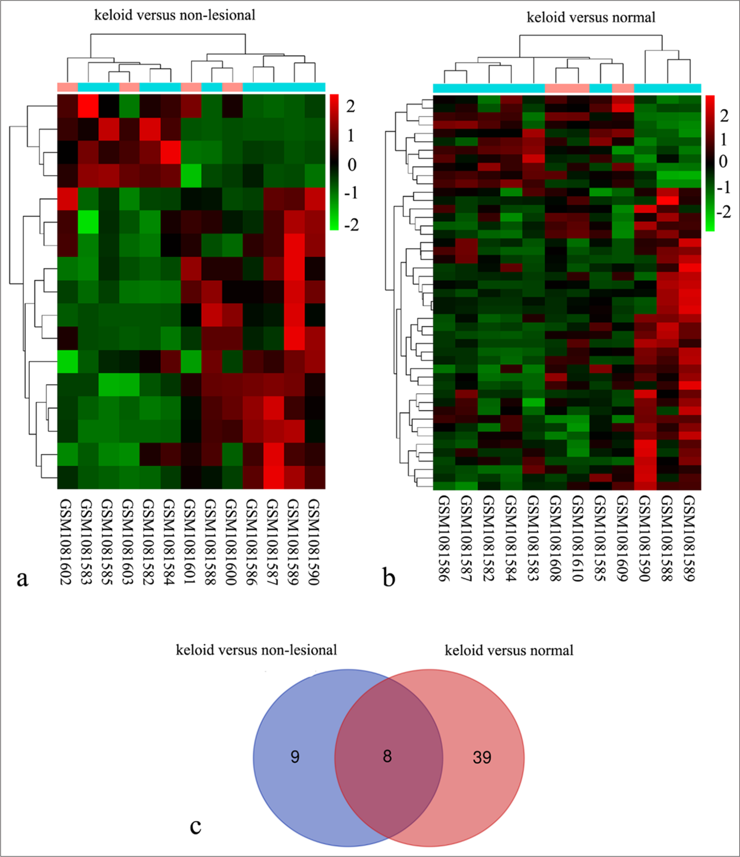 Ankyrin repeat domain 1 is dysregulated in keloids and suppresses keloid fibroblast growth, migration, and extracellular matrix deposition