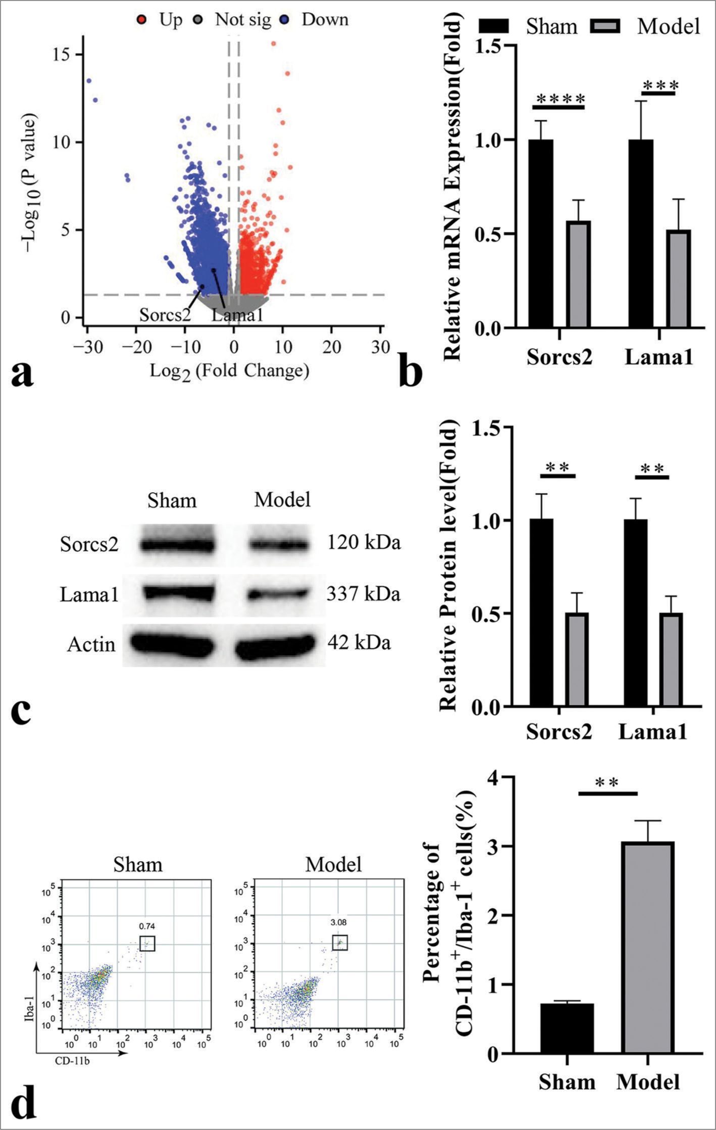 Astragalus polysaccharide attenuates retinal ischemia reperfusion-induced microglial activation through sortilin-related vacuolar protein sorting 10 domain containing receptor 2/laminin subunit alpha 1 upregulation