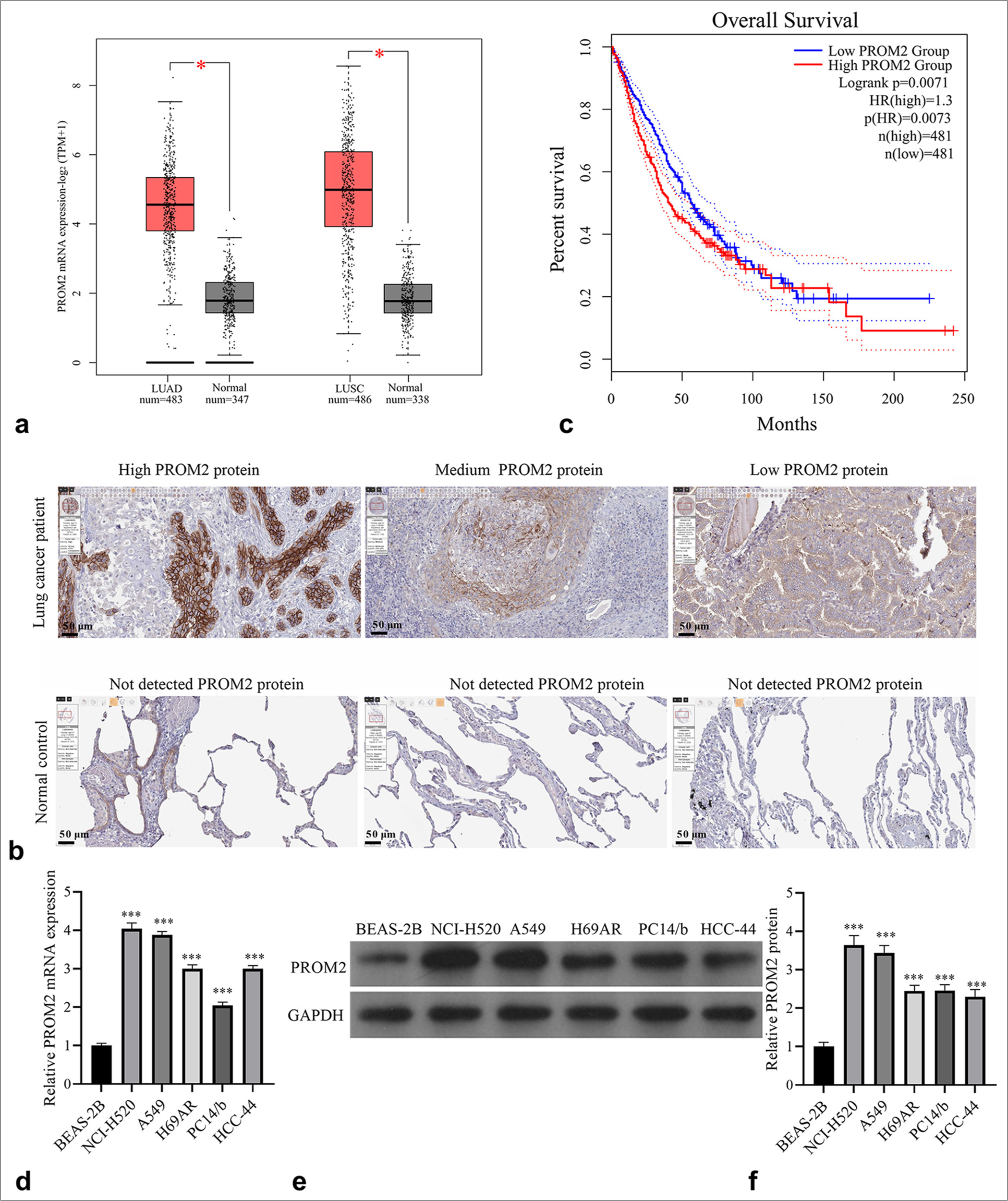 Prominin 2 knockdown inhibits the growth, migration, and invasion of non-small cell lung cancer cells by repressing phosphatidylinositol 3 kinase/protein kinase B pathway