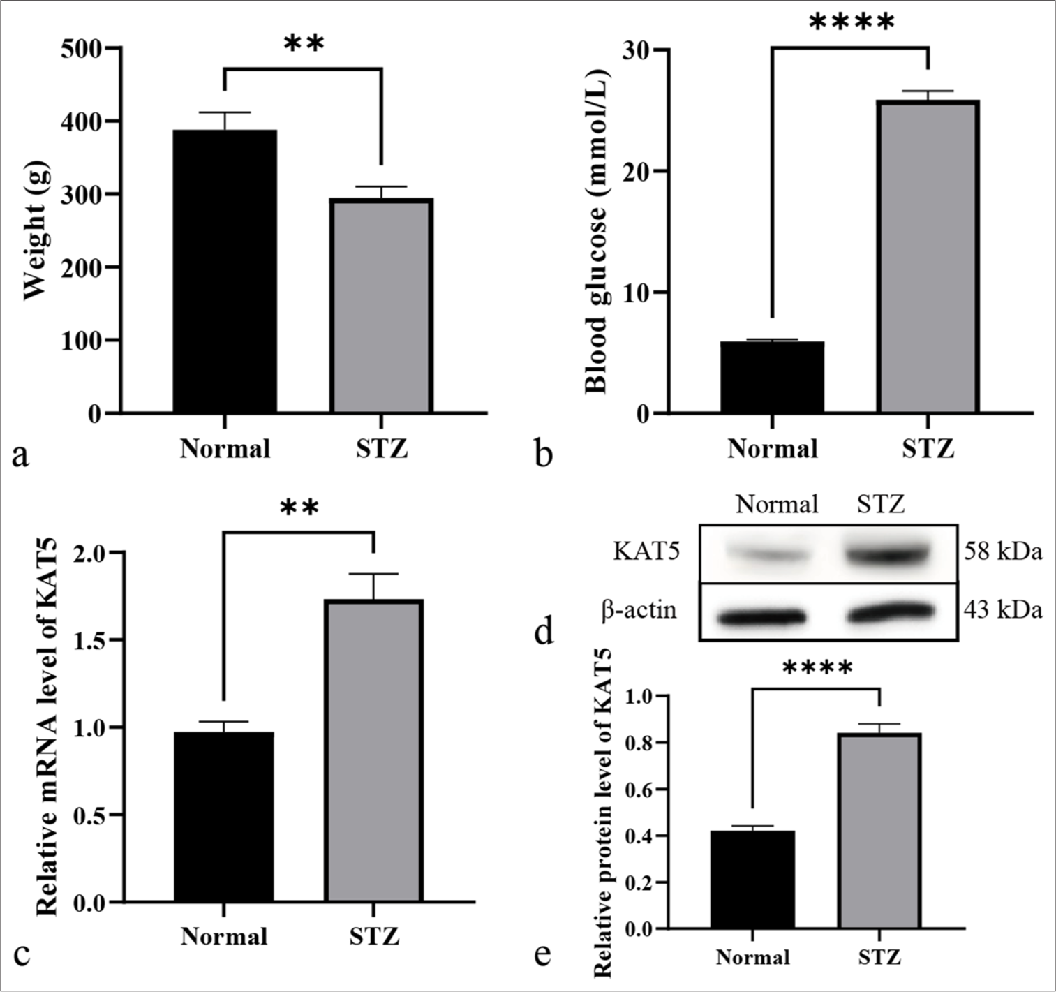 Lysine acetyltransferase 5 contributes to diabetic retinopathy by modulating autophagy through epigenetically regulating autophagy-related gene 7