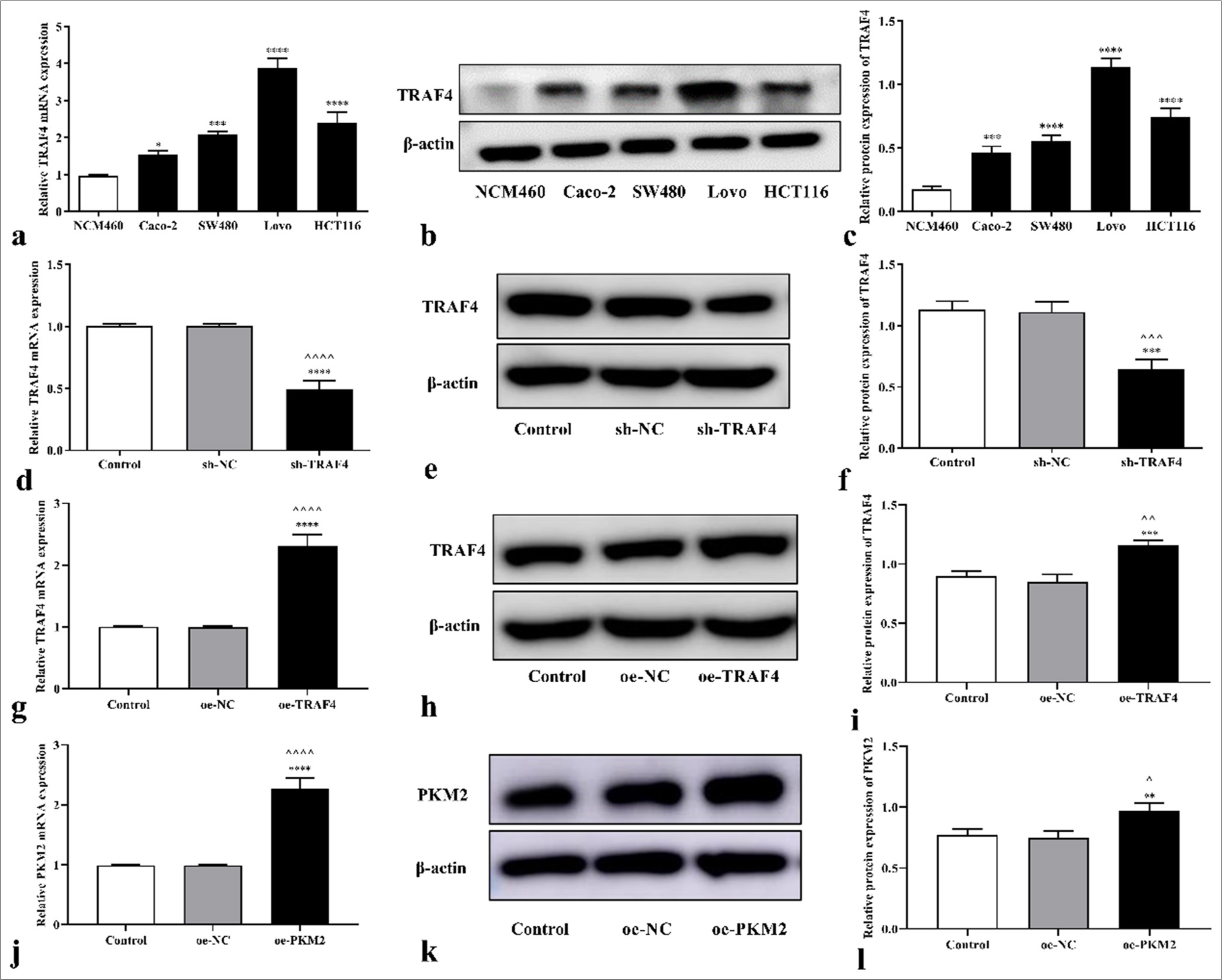 Interactions of tumor necrosis factor receptor-associated factor 4 and pyruvate kinase muscle isoform 2 promote malignant behavior and aerobic glycolysis in colorectal cancer cells