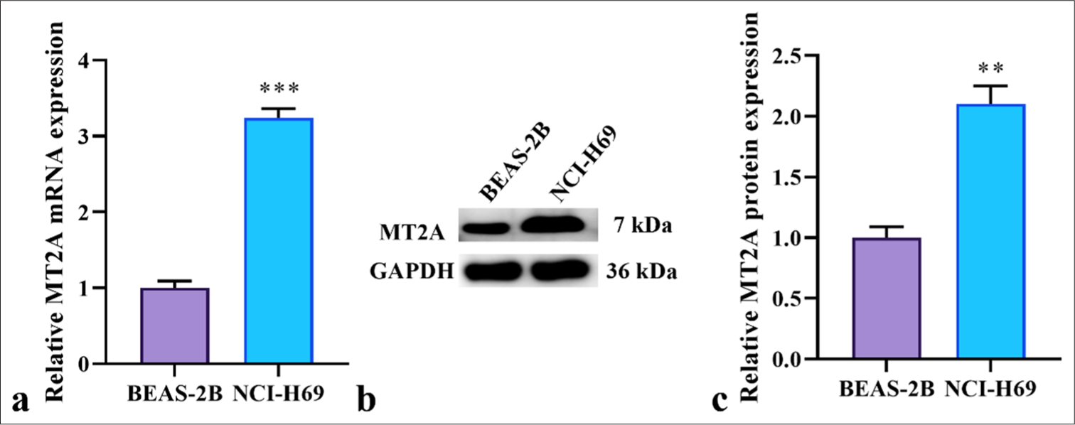 Metallothionein 2A enhances the yes-associated protein 1 signaling pathway to promote small-cell lung cancer metastasis