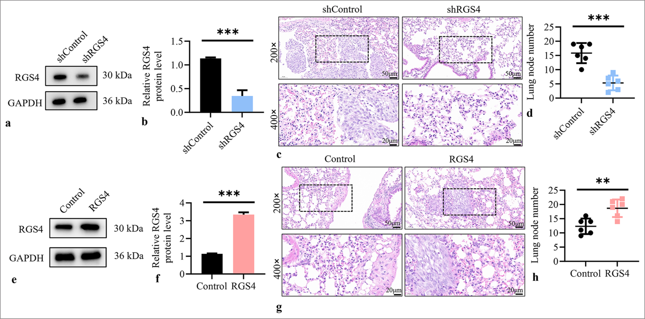 Emerging regulators of gastric cancer angiogenesis: Synergistic effects of regulator of G protein signaling 4 and midkine