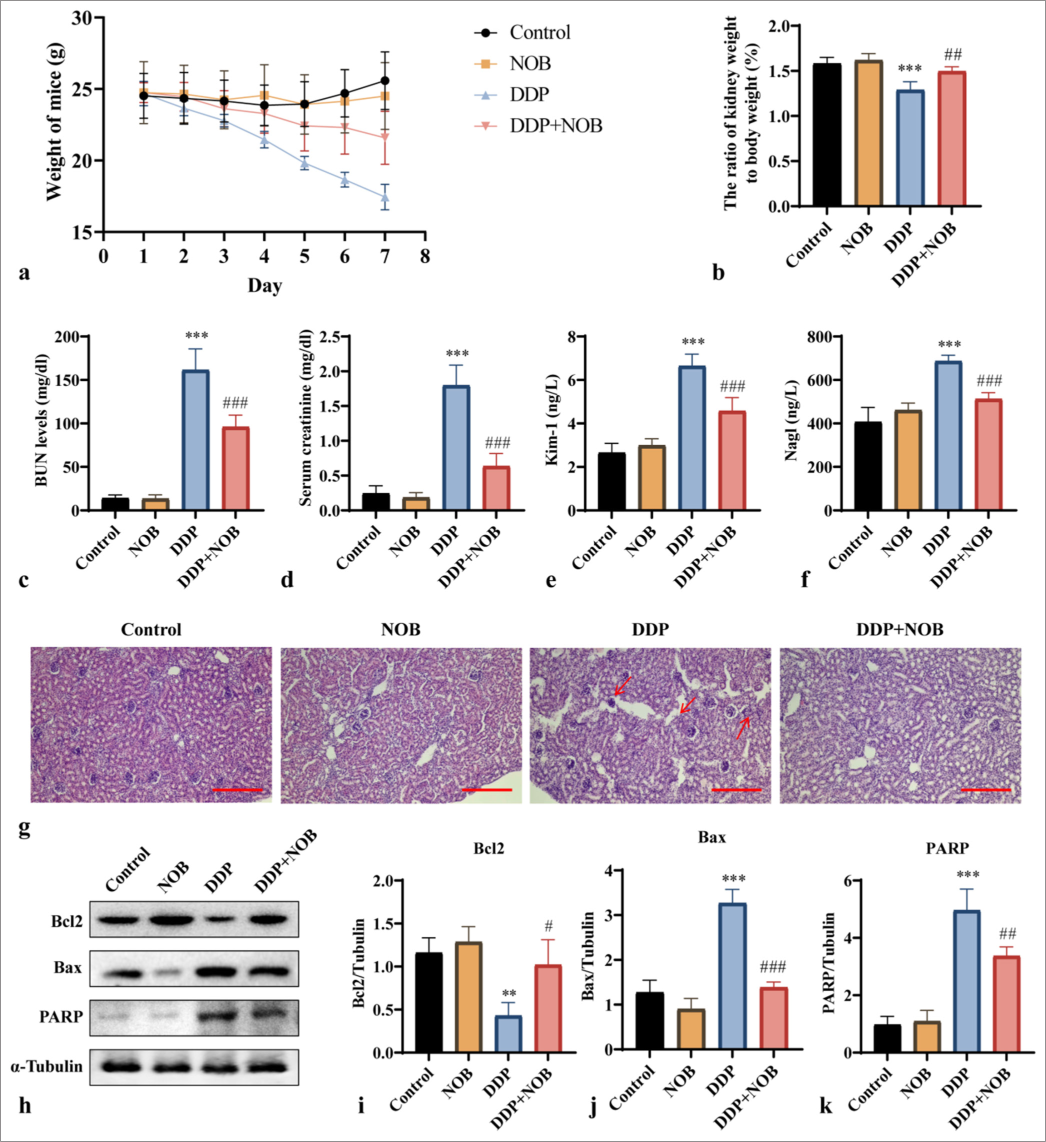 Nobiletin alleviates brain injury in uremic mice and inhibits indoxyl sulfate-induced neurotoxicity in HT22 cells through the phosphatidylinositol 3-kinase/protein kinase B signaling pathway