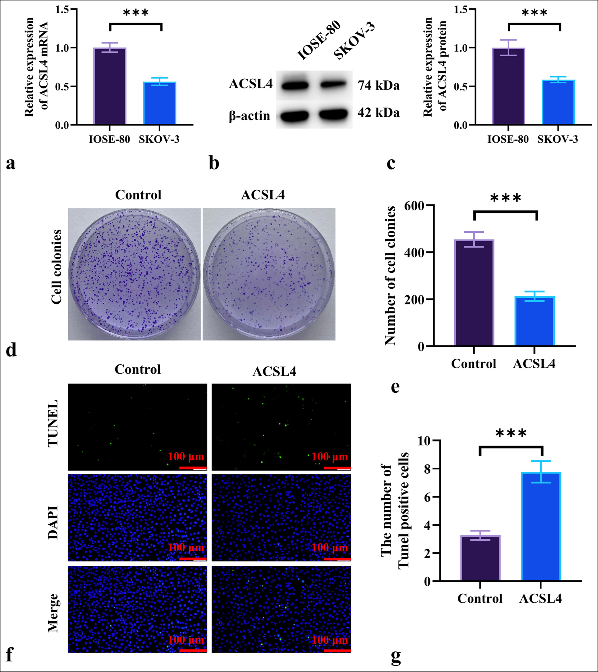 A new perspective: Acyl-CoA synthetase long-chain family member 4 inhibits ubiquitin-specific protease 7-induced epithelial ovarian cancer progression by inducing ferroptosis and M1 macrophage polarization