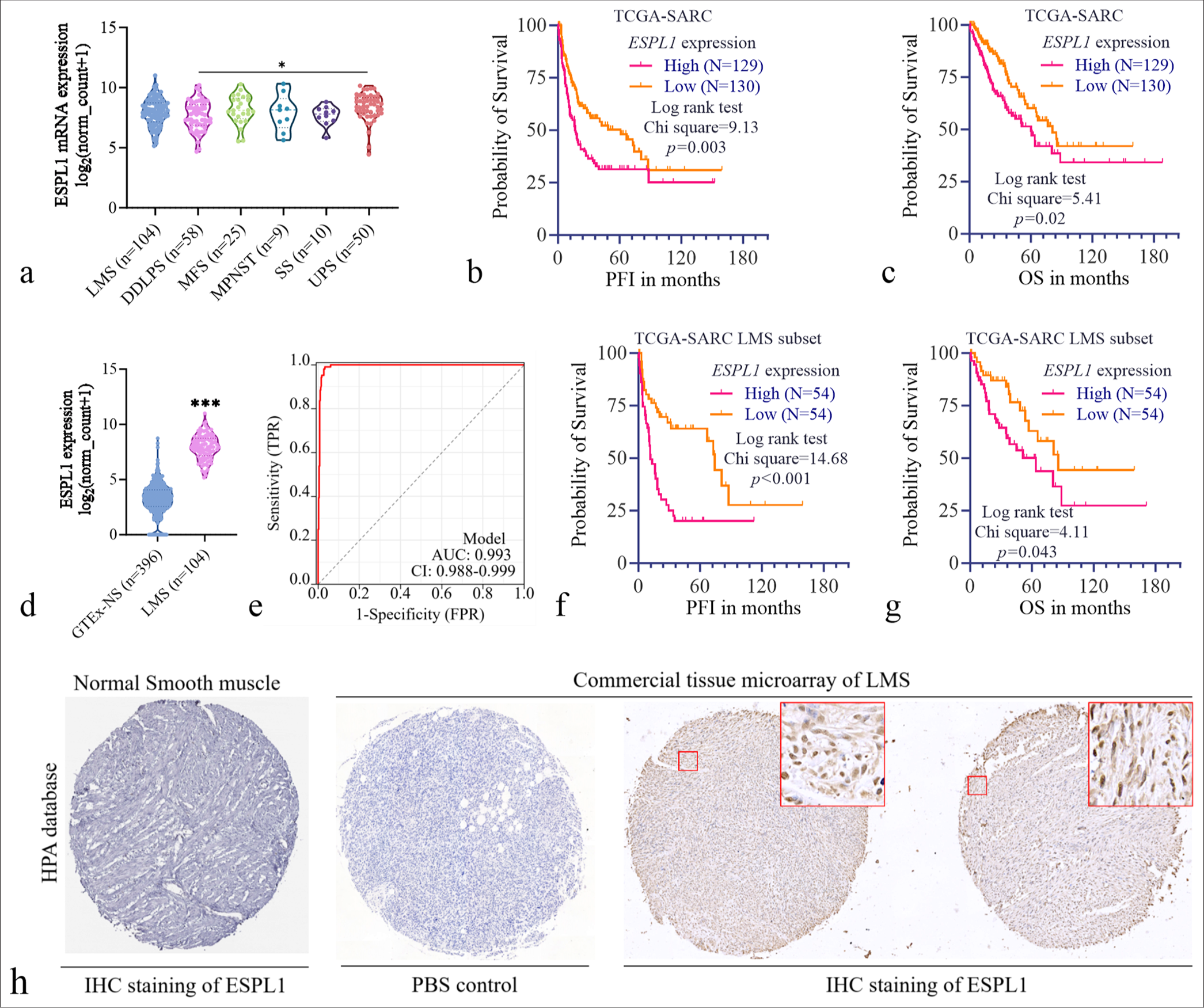 E2F1-mediated ESPL1 transcriptional activation predicts poor prognosis and promotes the proliferation of leiomyosarcoma