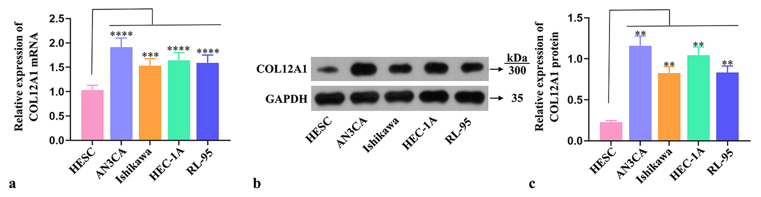 Inhibitory effect on endometrial cancer: Collagen type XII α1 chain