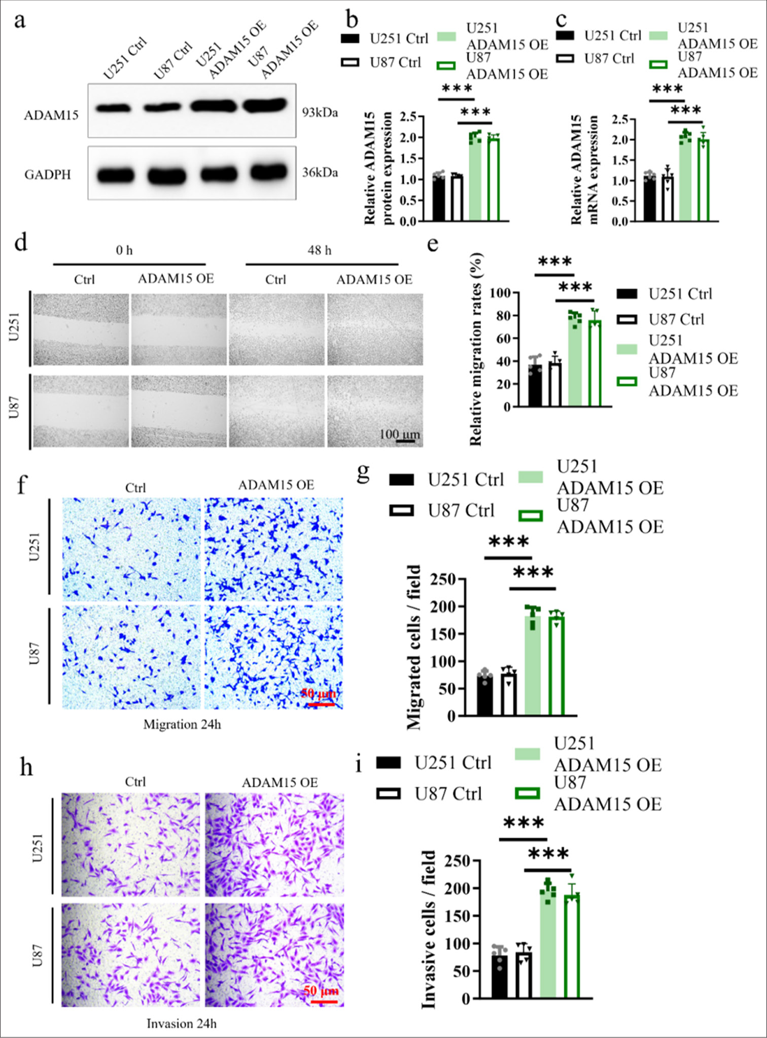 A disintegrin-like and metalloproteinase 15 facilitates glioblastoma proliferation and metastasis through activation of the protease-activated receptor 1