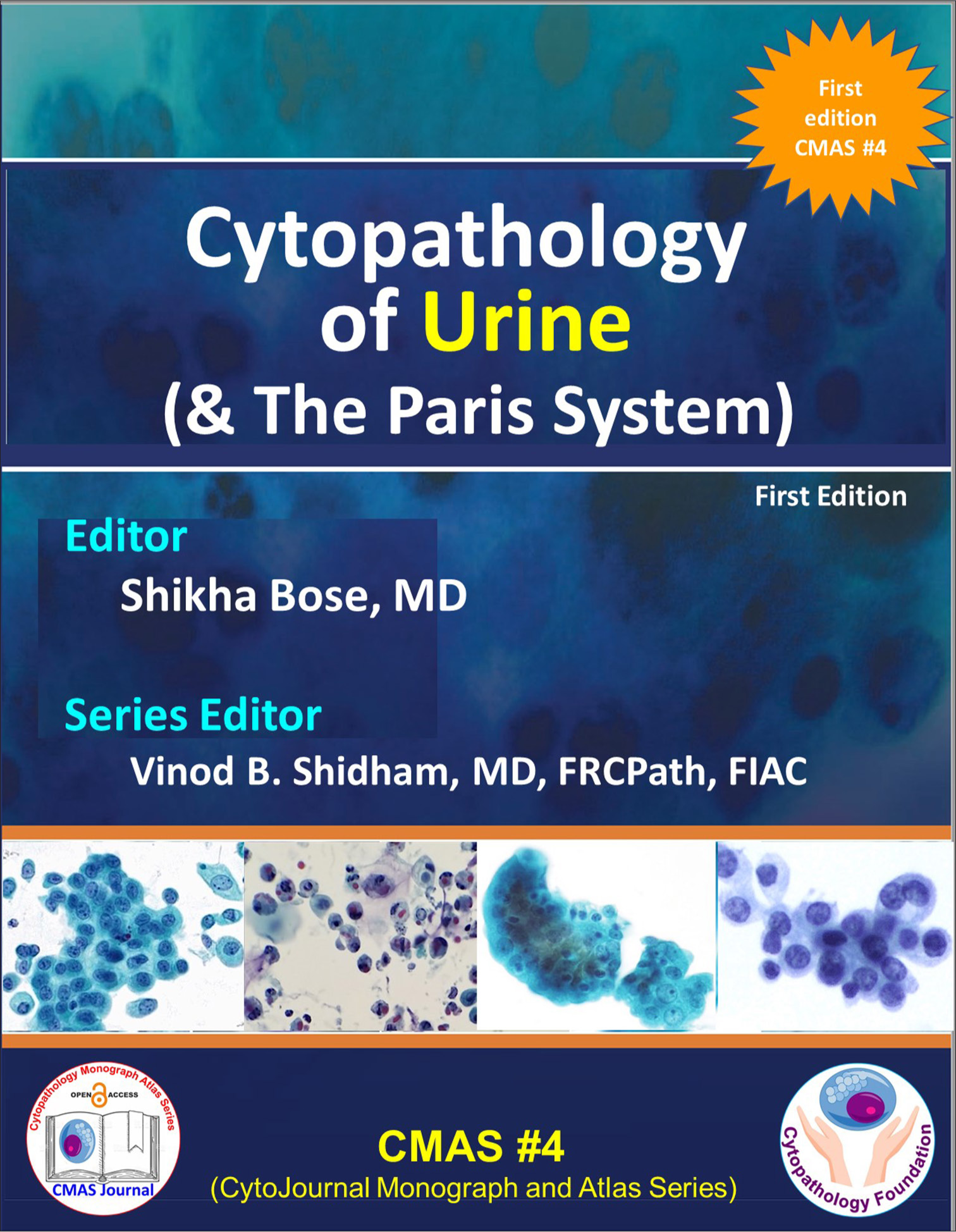 Fourth Cytopathology Monograph and Atlas Series Book Titled “Cytopathology of Urine (& The Paris System)” as Extension of Open Access Charter of Cytopathology Foundation Inc