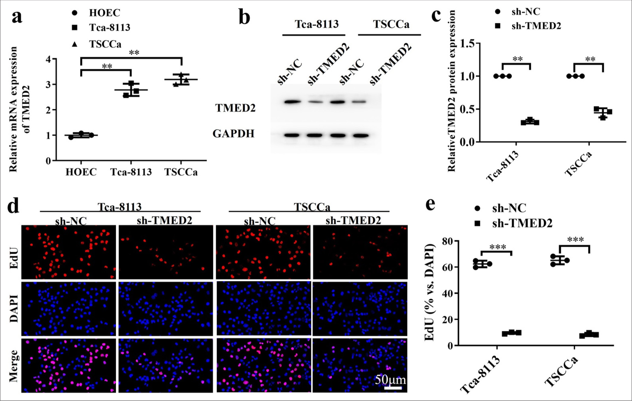 Relationship between transmembrane emp24 domain containing 2 expression and tumor stem cell characteristics in oral cancer