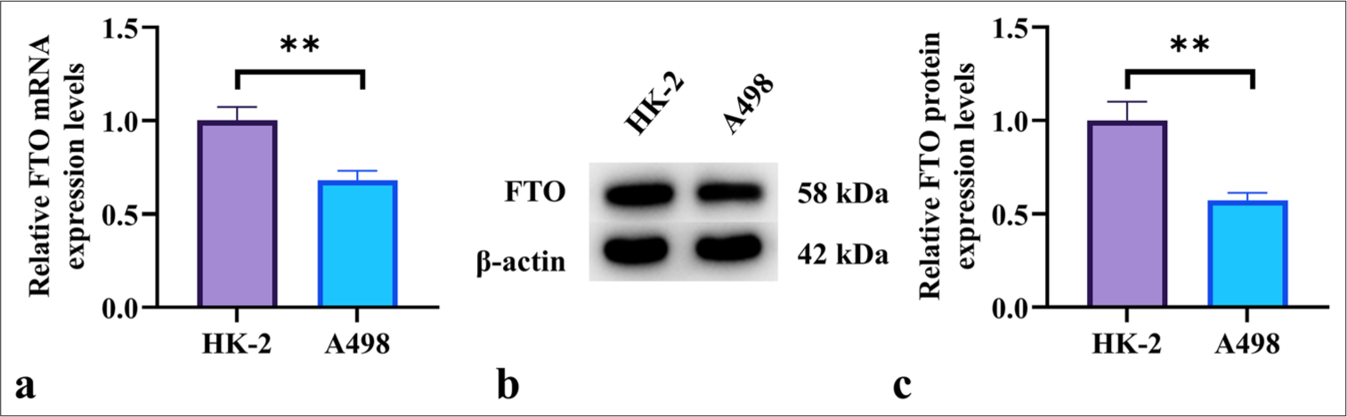 Fat mass and obesity-associated protein downregulation trigger the activation of the sirtuin 1/forkhead box O1 signaling pathway, drive glycolysis, and promote the progression of renal cell carcinoma