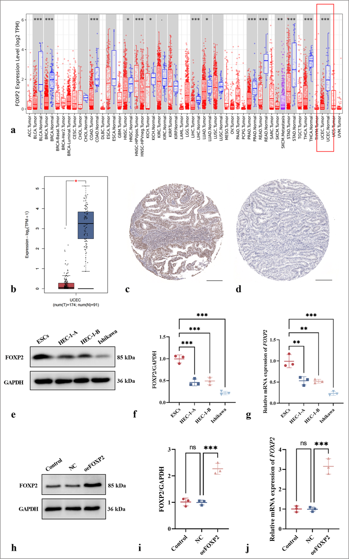 Effect of forkhead box protein P2-mediated activation of myosin light-chain kinase on the invasion and migration of endometrial cancer cells