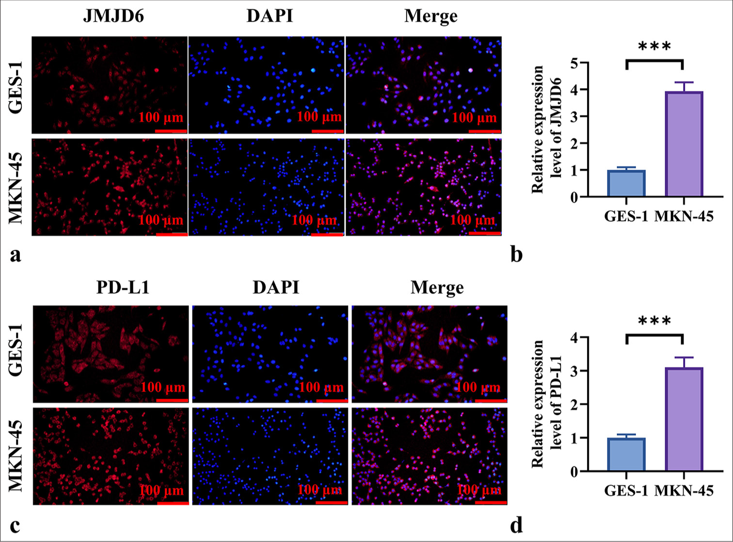 Jumonji domain-containing protein 6 promotes gastric cancer progression: Modulating immune evasion through autophagy and oxidative stress pathways