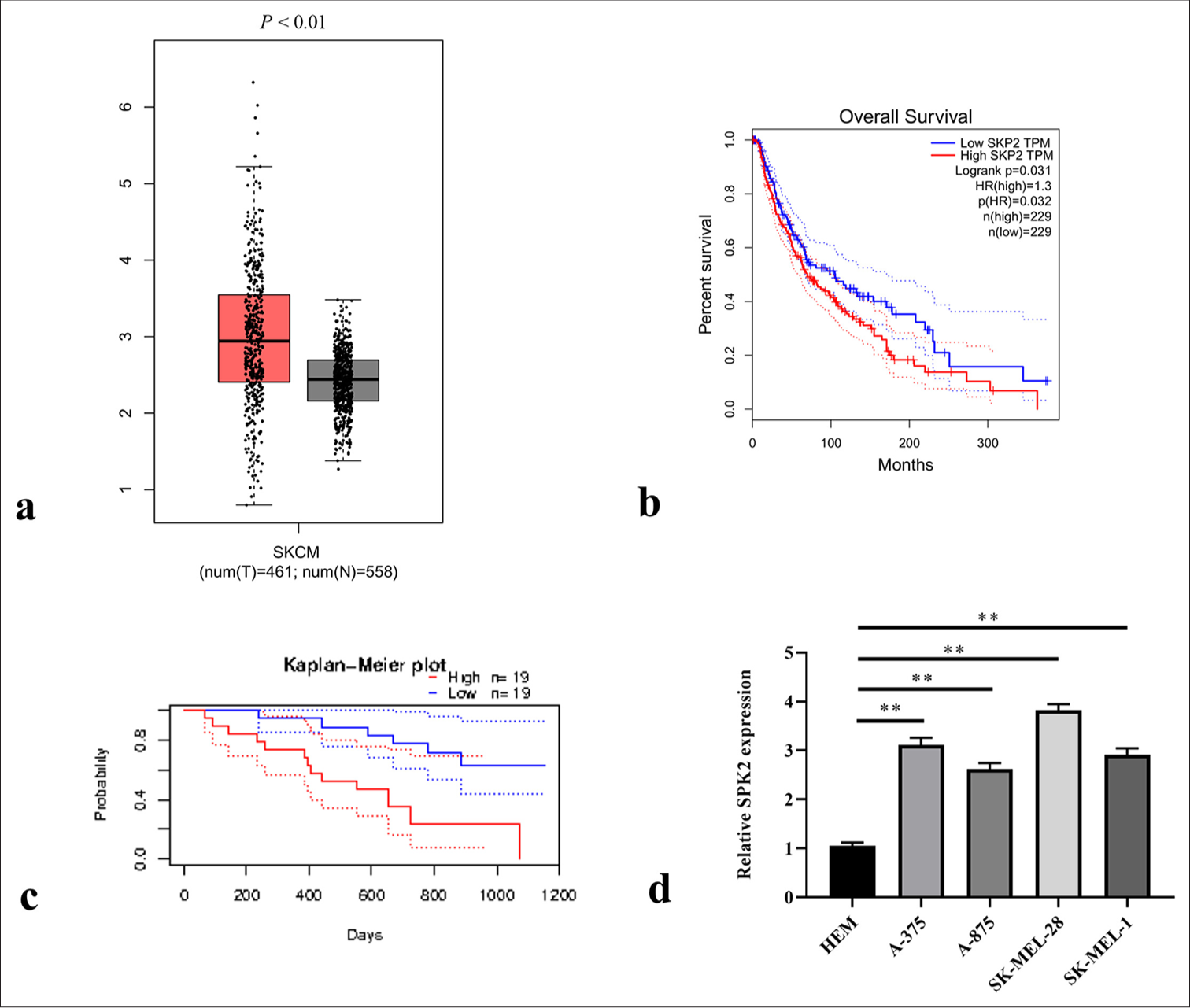 Hypoxia-induced S-phase kinase-interacting protein 2 knockdown repressed the progression of melanoma through extracellular signal-regulated kinase 1/2 pathway