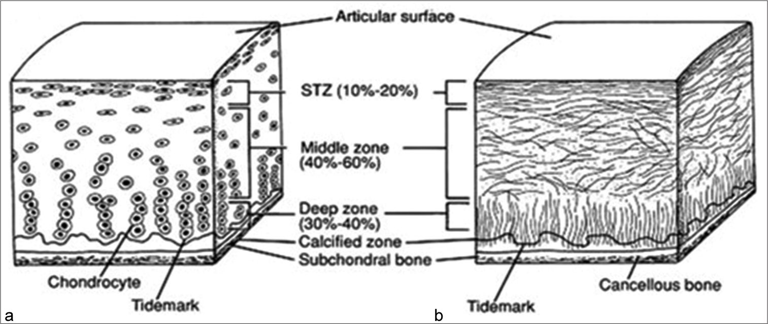 Evaluation of knee articular cartilage through calcium-suppressed technique in dual-energy computed tomography