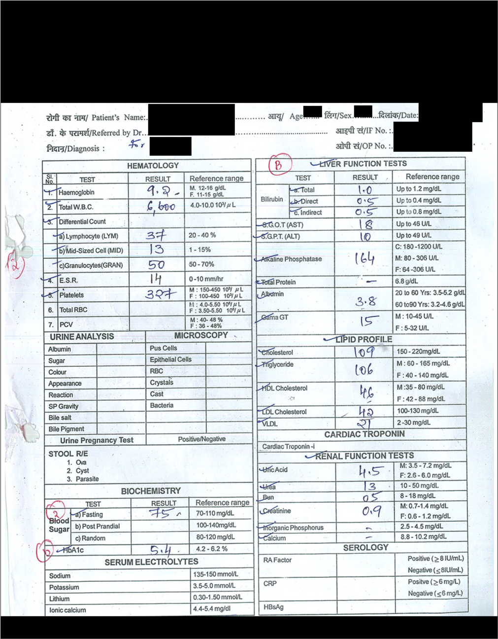 Alcohol dependence syndrome managed with homoeopathic medicine Bufo Rana – An evidence-based case report