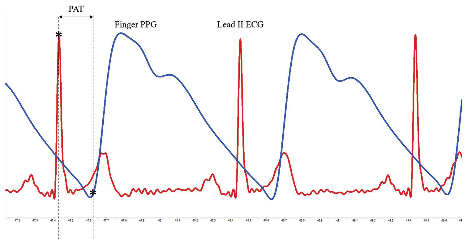 Exploring the repeatability of pulse arrival time in healthy subjects: A test-retest approach