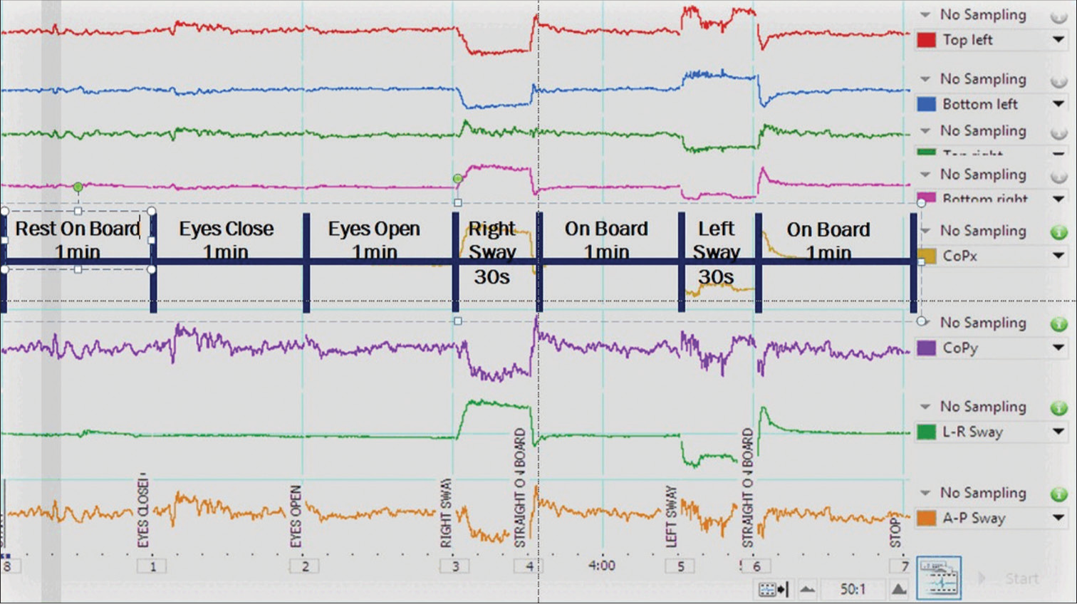 Sway detection in hypertension as a novel tool to anticipate risk and morbidity due to postural instability