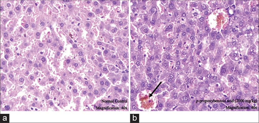 Acute oral toxicity evaluation of p-propoxybenzoic acid in Sprague-Dawley rats according to OECD guideline 425 – Up and down method