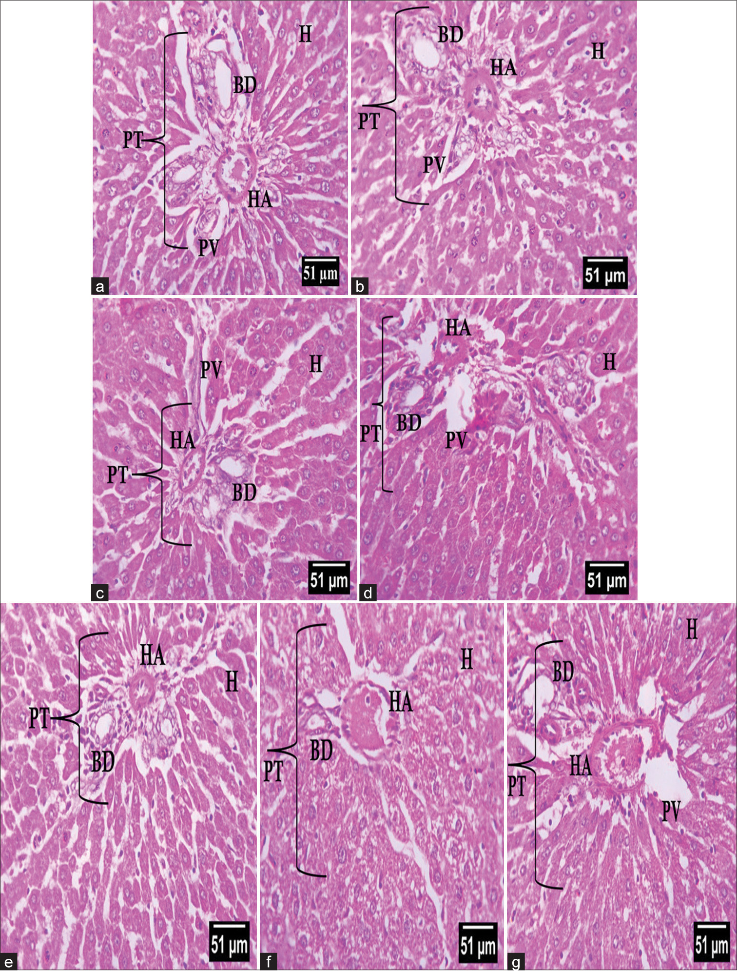 Modulatory effect of quercetin on aspirin-induced hepatoxicity in Wistar rats