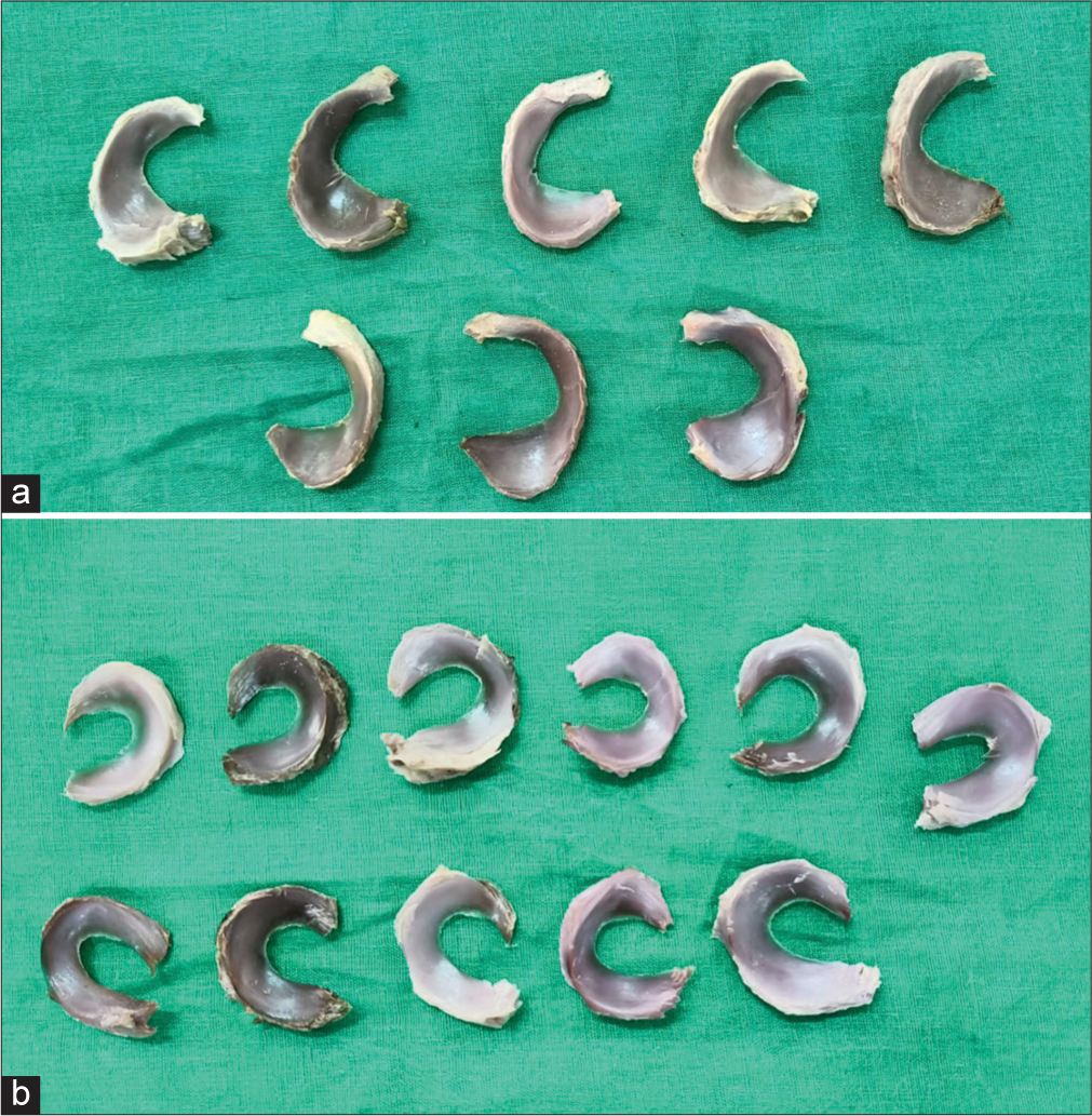 Morphometric analysis of menisci in Nepalese population: A cadaveric study