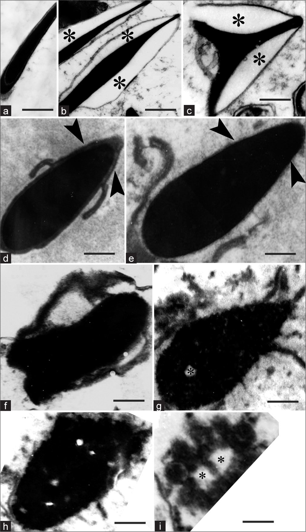 Control of sperm quality in the epididymis by disintegration and removal – A transmission electron microscopy study of abnormal sperm of aflatoxin-treated rat