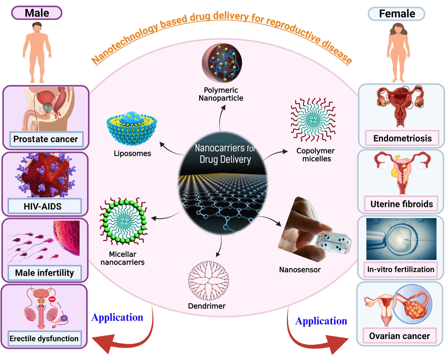 Nanotechnology advances in treatment of reproductive diseases: From bench to bedside