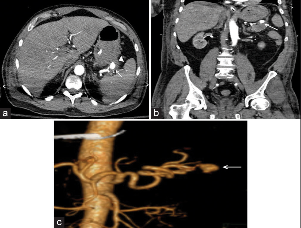 Unusual causes of gastrointestinal bleeding in the intensive care unit through the radiology lens