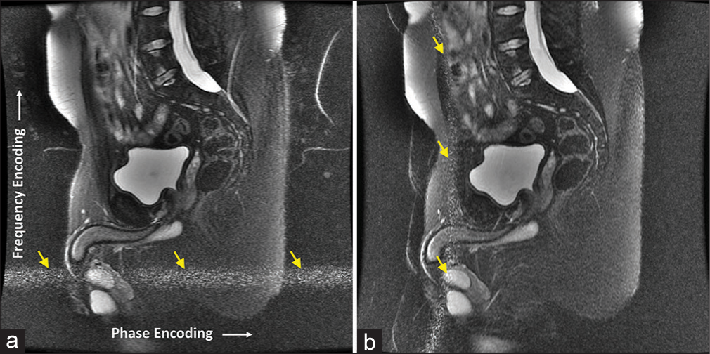 Radiofrequency interference in magnetic resonance imaging: Identification and rectification