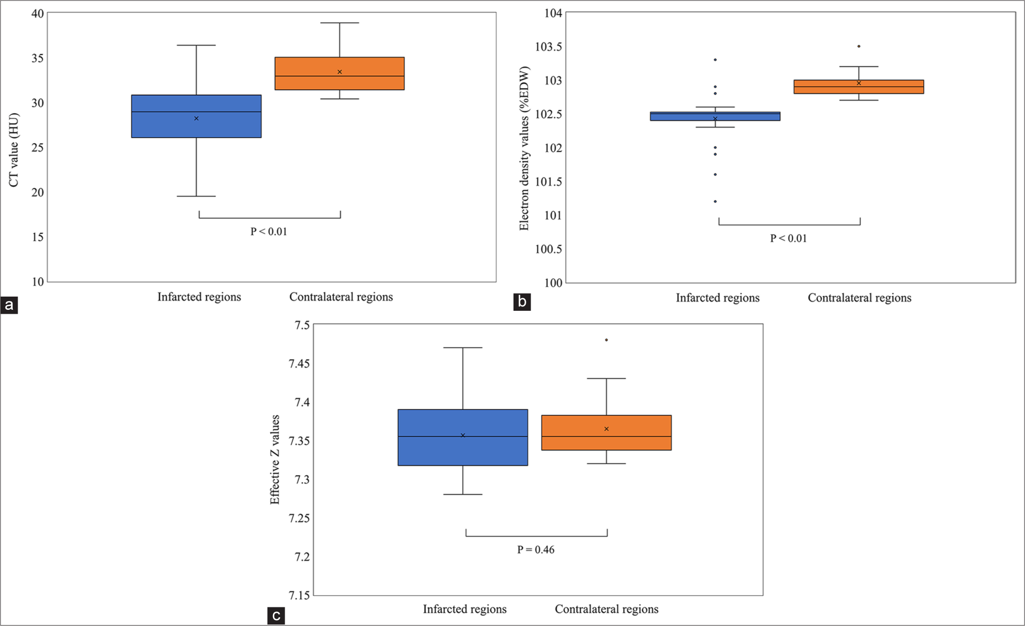 Efficacy of dual-layer spectral detector computed tomography for detecting early ischemic changes in patients with acute ischemic stroke: A pilot study