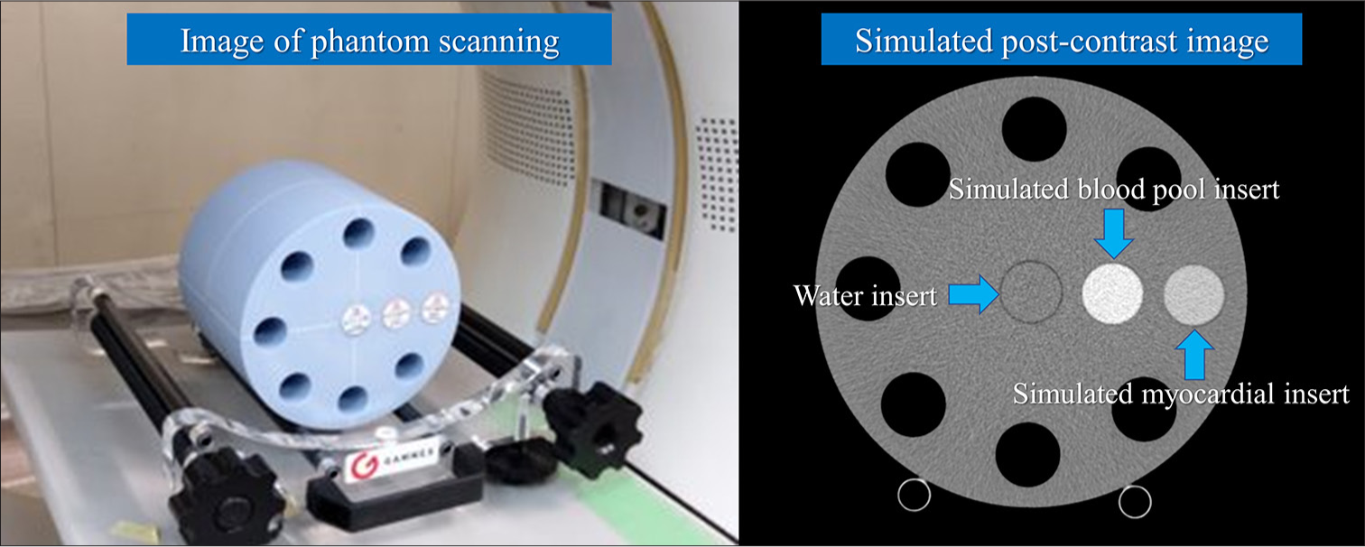 Basic verification of myocardial extracellular volume quantification by prototype photon-counting detector computed tomography: A phantom study