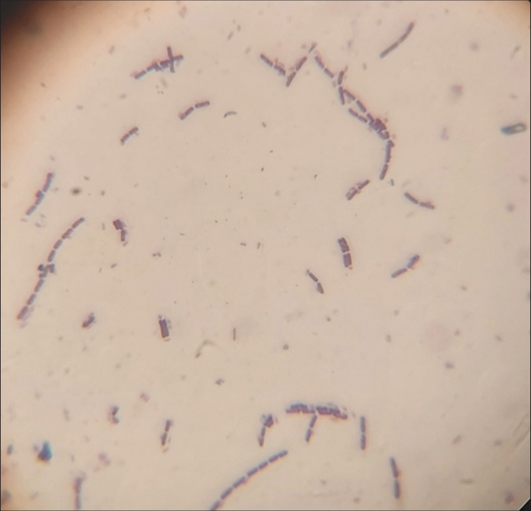 Multidrug-Resistant Corynebacterium spp., Escherichia coli, and Klebsiella spp. Isolated from the Lungs of a Six-Year-Old Arewa Stallion