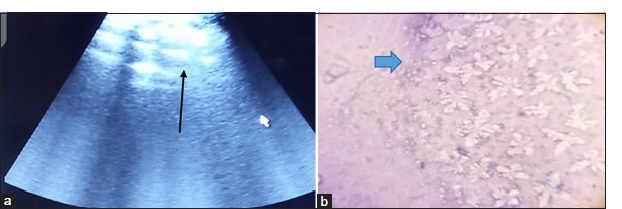 Pathological Findings of Feline Pansteatitis (Yellow Fat Disease) in a 9-Month-Old Siberian Queen